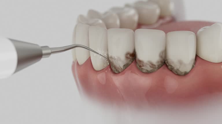 Reliable Dental Implants contractor in Central, TN by Smile Center Dentistry